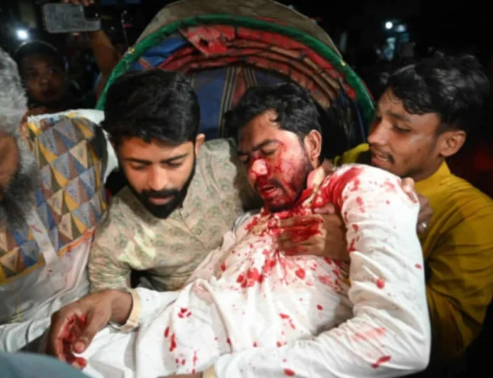 Nurul Haque Nur Seriously Injured in Kakrail Clash, Now in ICU at Dhaka Medical